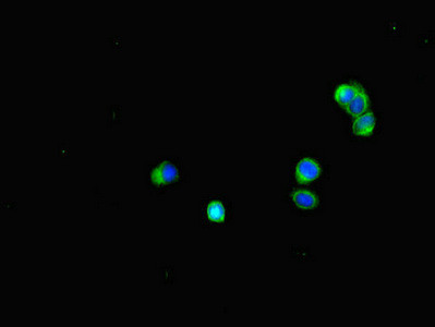 BUBR1 Antibody in Immunocytochemistry (ICC/IF)