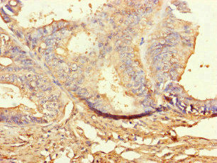 BUBR1 Antibody in Immunohistochemistry (Paraffin) (IHC (P))