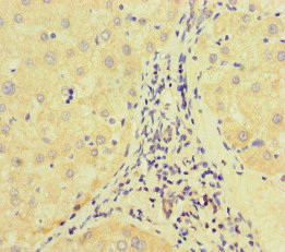 E2F1 Antibody in Immunohistochemistry (Paraffin) (IHC (P))