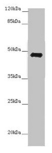 E2F1 Antibody in Western Blot (WB)