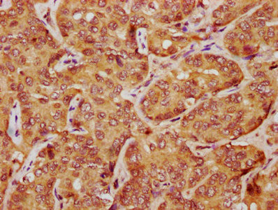 LATS1 Antibody in Immunohistochemistry (Paraffin) (IHC (P))