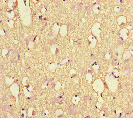 NEFL Antibody in Immunohistochemistry (Paraffin) (IHC (P))