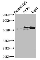 NEFL Antibody in Immunoprecipitation (IP)