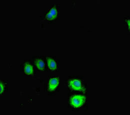 SRGAP2C Antibody in Immunocytochemistry (ICC/IF)