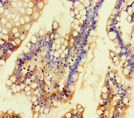 TALK-1 Antibody in Immunohistochemistry (Paraffin) (IHC (P))