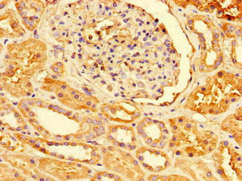 PRDX3 Antibody in Immunohistochemistry (Paraffin) (IHC (P))