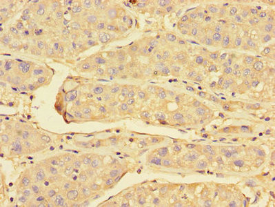 PRDX3 Antibody in Immunohistochemistry (Paraffin) (IHC (P))