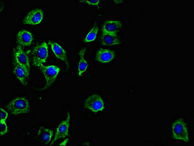 PKD1L3 Antibody in Immunocytochemistry (ICC/IF)