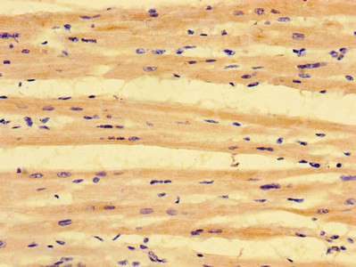 PKD1L3 Antibody in Immunohistochemistry (Paraffin) (IHC (P))