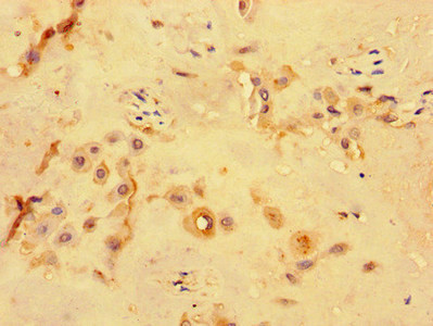 PKD1L3 Antibody in Immunohistochemistry (Paraffin) (IHC (P))