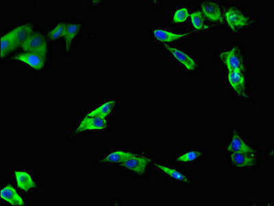 LIPG Antibody in Immunocytochemistry (ICC/IF)