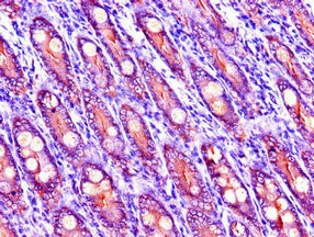 LIPG Antibody in Immunohistochemistry (Paraffin) (IHC (P))