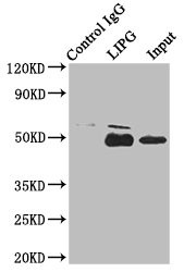 LIPG Antibody in Immunoprecipitation (IP)