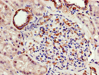 ATP5A1 Antibody in Immunohistochemistry (Paraffin) (IHC (P))