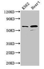 ATP5A1 Antibody in Western Blot (WB)