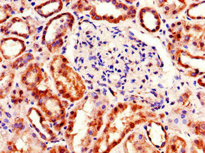 TDRD12 Antibody in Immunohistochemistry (Paraffin) (IHC (P))