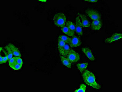 GARS Antibody in Immunocytochemistry (ICC/IF)