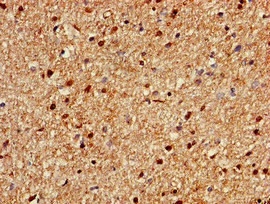 C1orf84 Antibody in Immunohistochemistry (Paraffin) (IHC (P))