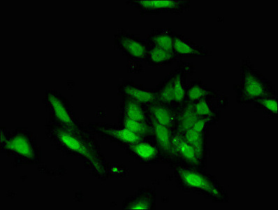 ASH1 Antibody in Immunocytochemistry (ICC/IF)