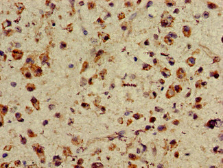 ASH1 Antibody in Immunohistochemistry (Paraffin) (IHC (P))