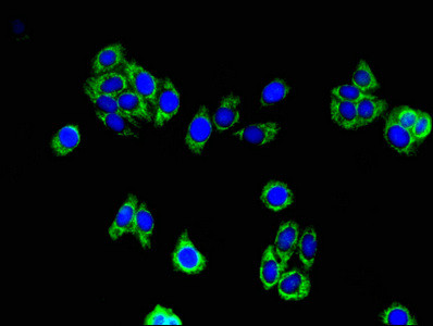 ACAA2 Antibody in Immunocytochemistry (ICC/IF)