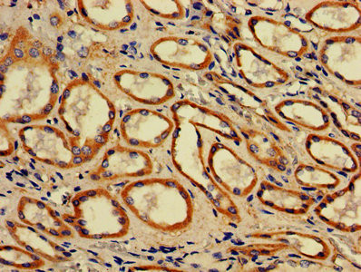 ACAA2 Antibody in Immunohistochemistry (Paraffin) (IHC (P))