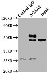 ACAA2 Antibody in Immunoprecipitation (IP)