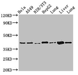 ACAA2 Antibody in Western Blot (WB)