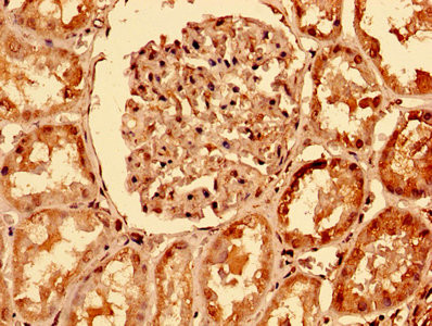 DR4 Antibody in Immunohistochemistry (Paraffin) (IHC (P))