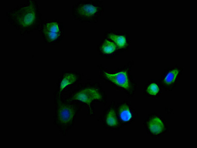 C19orf12 Antibody in Immunocytochemistry (ICC/IF)