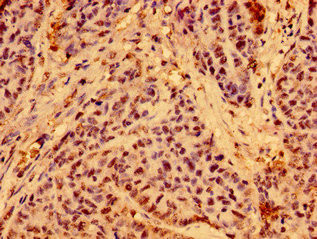 C19orf12 Antibody in Immunohistochemistry (Paraffin) (IHC (P))