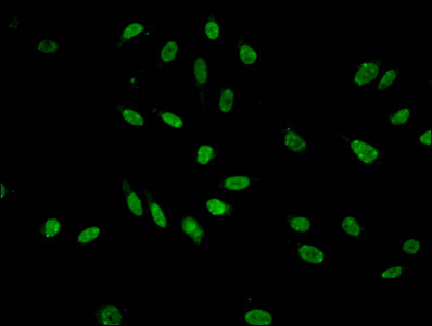 H3K9me1 Antibody in Immunocytochemistry (ICC/IF)