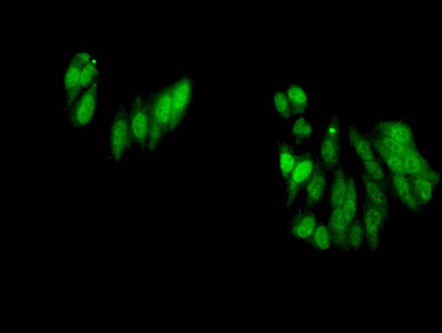 H3R17me2a Antibody in Immunocytochemistry (ICC/IF)