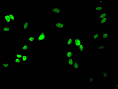 H3R17me2a Antibody in Immunocytochemistry (ICC/IF)