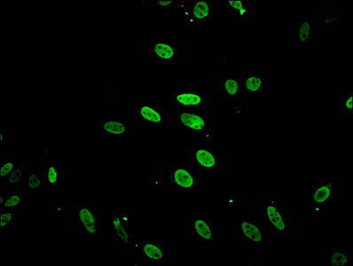 Acetyl-HIST1H2BB (Lys5) Antibody in Immunocytochemistry (ICC/IF)