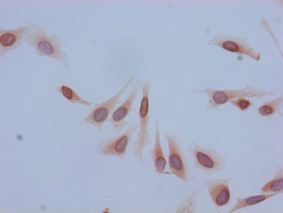 Acetyl-HIST1H2BB (Lys5) Antibody in Immunocytochemistry (ICC/IF)