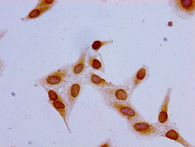 Acetyl-Histone H1.2 (Lys16) Antibody in Immunocytochemistry (ICC/IF)