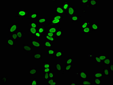 Mono-methyl-Histone H2A.Z (Lys4) Antibody in Immunocytochemistry (ICC/IF)