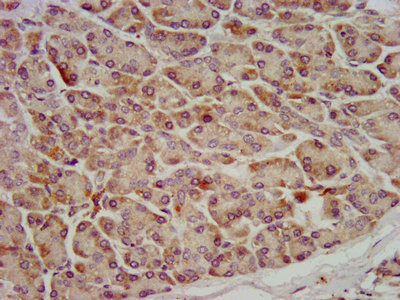 OCC1 Antibody in Immunohistochemistry (Paraffin) (IHC (P))