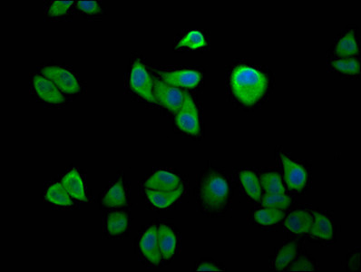 IKAP Antibody in Immunocytochemistry (ICC/IF)