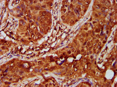 IKAP Antibody in Immunohistochemistry (Paraffin) (IHC (P))