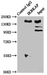 IKAP Antibody in Immunoprecipitation (IP)