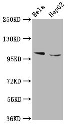 IKAP Antibody in Western Blot (WB)