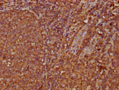 IGHA2 Antibody in Immunohistochemistry (Paraffin) (IHC (P))