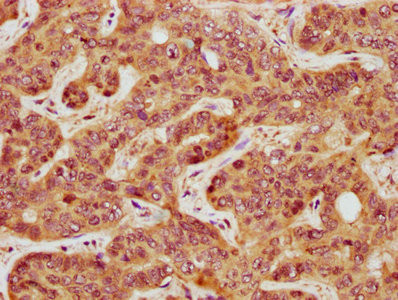 GATS Antibody in Immunohistochemistry (Paraffin) (IHC (P))