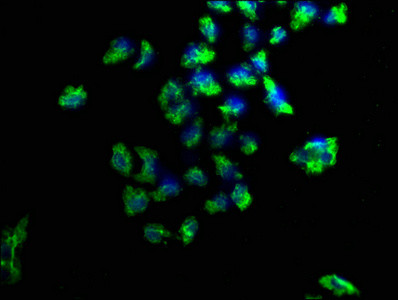 PKC mu Antibody in Immunocytochemistry (ICC/IF)