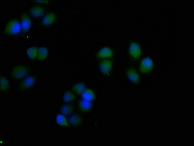 S100A7 Antibody in Immunocytochemistry (ICC/IF)