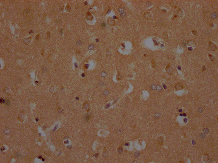 OR10A2 Antibody in Immunohistochemistry (Paraffin) (IHC (P))