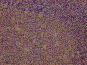 PCDHB7 Antibody in Immunohistochemistry (Paraffin) (IHC (P))