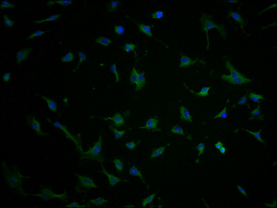 TBC1D3G Antibody in Immunocytochemistry (ICC/IF)